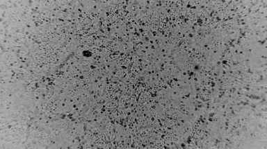 Lần đầu tiên tái tạo virus corona ngoài Trung Quốc