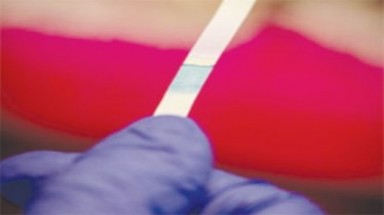  Băng giấy phát hiện khuẩn E.Coli