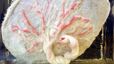 Quảng Ninh: Không có chuyện các cơ sở y tế để lọt rau thai, bào thai ra ngoài 