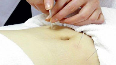 Cấy chỉ điều trị tự kỷ có tốn kém?