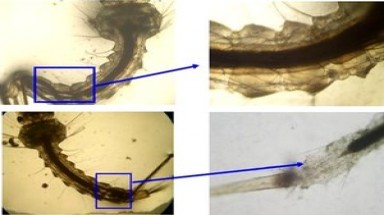  Diệt bọ gậy bằng sóng siêu âm
