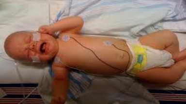 Trẻ sơ sinh có thể bị hạ đường huyết?