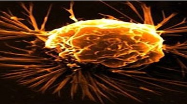 Mỗi năm, 82.000 người VN chết do ung thư