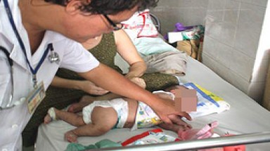  Bí ẩn nguồn lây bệnh ca thứ hai bị amip ăn não