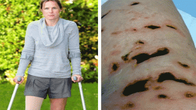  Thái Lan: Du khách bị "sinh vật lạ" gặm chân nham nhở 