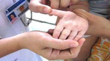 Tây Ninh: 95 xã có dịch tay chân miệng