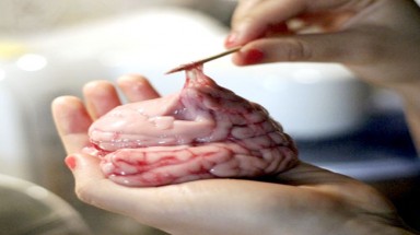 Người mắc chứng hay quên nên ăn gì?