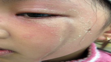  Kiến ba khoang lại gây lo lắng