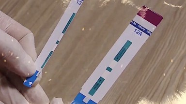 Bệnh viện Xanh Pôn cắt đôi que xét nghiệm HIV, viêm gan B