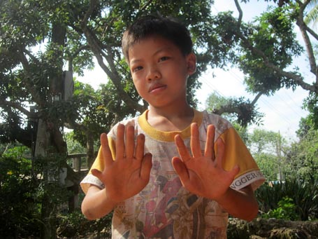 Gia[-]tộc[-]24[-]ngón[-]kỳ[-]lạ[-]nhất[-]Việt[-]Nam